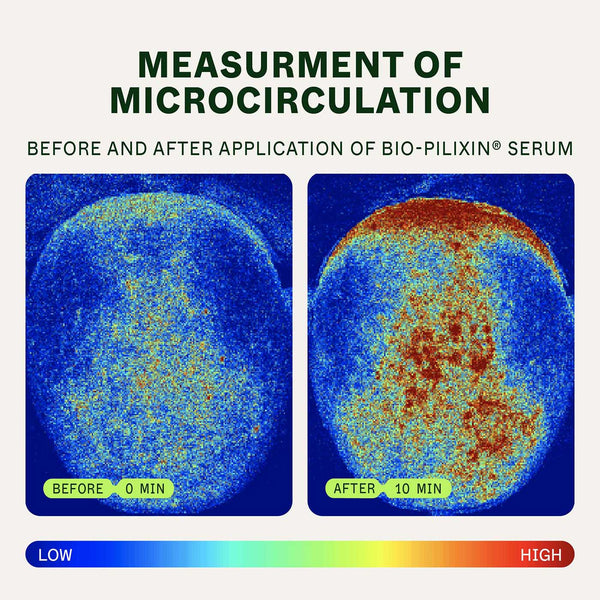 Hair Activation & Nutrient Bundle | For Women