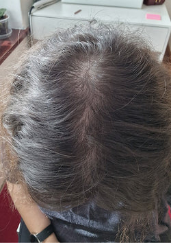 After treatment