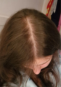 Before treatment