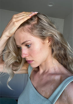 Before treatment